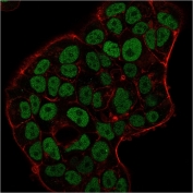 Immunofluorescence staining of PFA-fixed human MCF-7 cells with MSH6 antibody (green, clone MSH6/3091) and Phalloidin (red).