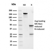 SDS-PAGE analysis of purified, BSA-free MSH6 antibody (clone MSH6/3091) as confirmation of integrity and purity.