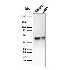 Western blot testing of human samples with recombinant Alpha 1 Antitrypsin antibody (clone AAT/3167R). Expected molecular weight: ~47 kDa (unmodified), 52 kDa (glycosylated).