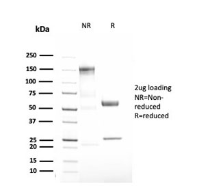 SDS-PAGE analysis of purified, BSA-free recombinant Alpha 1 Antitrypsin antibody (clone AAT/3167R) as confirmation of integrity and purity.