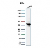 Western blot testing of human lung tissue lysate with recombinant Alpha 1 Antitrypsin antibody. Expected molecular weight: 47-52 kDa depending on the level of glycosylation.