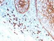 IHC staining of FFPE human tonsil with CD11b antibody (clone ITGAM/3339). HIER: boil tissue sections in pH 9 10mM Tris with 1mM EDTA for 20 min and allow to cool before testing.