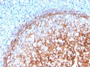 IHC staining of FFPE human tonsil with CD11b antibody (clone ITGAM/3339). HIER: boil tissue sections in pH 9 10mM Tris with 1mM EDTA for 20 min and allow to cool before testing.