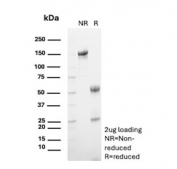 SDS-PAGE analysis of purified, BSA-free CD11b antibody (clone ITGAM/3339) as confirmation of integrity and purity.