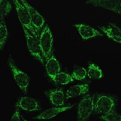 Immunofluorescent staining of PFA-fixed human HeLa cells with recombinant Cytochrome C antibody (clone CYCS/3128R, green).