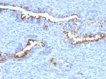 IHC staining of FFPE human endometrium with Podocalyxin antibody (clone PODXL/2184). HIER: boil tissue sections in pH 9 10mM Tris with 1mM EDTA for 20 min and allow to cool before testing.~