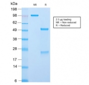 SDS-PAGE analysis of purified, BSA-free recombinant CLIP antibody (clone CLIP/2859R) as confirmation of integrity and purity.