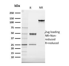 SDS-PAGE analysis of purified, BSA-free Cytokeratin 20 antibody (clone SPM140) as confirmation of integrity and purity.