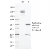 SDS-PAGE analysis of purified, BSA-free Cytokeratin 20 antibody (clone SPM191) as confirmation of integrity and purity.