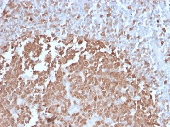 IHC testing of FFPE human tonsil with BOB.1 antibody. HIER: boil tissue sections in pH 9 10mM Tris with 1mM EDTA for 10-20 min followed by cooling at RT for 20 min.