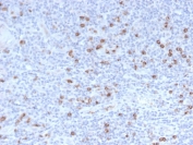 IHC staining of FFPE human tonsil with Granzyme B antibody (clone GZMB/3014). HIER: boil tissue sections in pH 9 10mM Tris with 1mM EDTA for 10-20 min and allow to cool before testing.