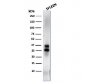 Western blot testing of human spleen lysate with Granzyme B antibody (clone GZMB/3014). Predicted molecular weight: 29-37 kDa.