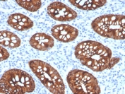 IHC testing of FFPE human colon tissue with recombinant Cytokeratin 8 antibody (clone KRT8/4067R). Required HIER: boil tissue sections in pH 9 10mM Tris with 1mM EDTA for 10-20 min followed by cooling at RT for 20 min.