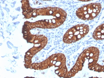 IHC testing of FFPE human colon tissue with recombinant Cytokeratin 8 antibody (clone KRT8/4067R). Required HIER: boil tissue sections in pH 9 10mM Tris with 1mM EDTA for 10-20 min followed by cooling at RT for 20 min.~