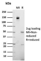 PSAP Antibody Clone PASE/4LJ SDS-PAGE analysis of antibody purity under reducing and non-reducing conditions. Purified PSAP Antibody Clone PASE/4LJ was analyzed by SDS-PAGE with 2 ug protein loading. The non-reduced lane (NR) shows the intact antibody migrating at approximately 150 kDa, corresponding to the expected molecular weight of a full IgG molecule. Under reducing conditions (R), the antibody separates into the expected heavy chain band at approximately 50 kDa and light chain band at approximately 25 kDa, confirming the purity and structural integrity of the PSAP antibody preparation.