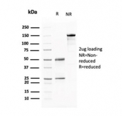 SDS-PAGE analysis of purified, BSA-free BARX1 antibody (clone BARX1/2760) as confirmation of integrity and purity.