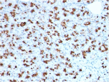 IHC staining of FFPE human pancreas with BARX1 antibody (clone BARX1/2760). HIER: boil tissue sections in pH 9 10mM Tris with 1mM EDTA for 20 min and allow to cool before testing.~