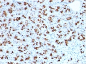 IHC staining of FFPE human pancreas with BARX1 antibody (clone BARX1/2760). HIER: boil tissue sections in pH 9 10mM Tris with 1mM EDTA for 20 min and allow to cool before testing.