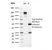SDS-PAGE analysis of purified, BSA-free BARX1 antibody (clone BARX1/2759) as confirmation of integrity and purity.