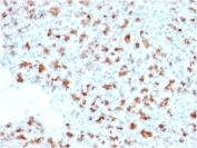IHC staining of FFPE human pancreas with BARX1 antibody (clone BARX1/2759). HIER: boil tissue sections in pH 9 10mM Tris with 1mM EDTA for 20 min and allow to cool before testing.