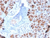 IHC staining of FFPE human pancreas with BARX1 antibody (clone BARX1/2759). HIER: boil tissue sections in pH 9 10mM Tris with 1mM EDTA for 20 min and allow to cool before testing.