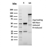 SDS-PAGE analysis of purified, BSA-free recombinant Prolactin Receptor antibody (clone PRLR/3785R) as confirmation of integrity and purity.