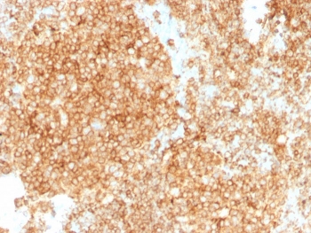 IHC staining of FFPE human tonsil with CD45 antibody. HIER: boil tissue sections in pH 9 10mM Tris with 1mM EDTA for 10-20 min and allow to cool before testing.~