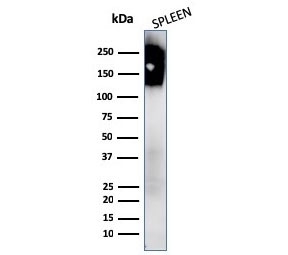 Western blot testing of human spleen lysate with CD45 antibody. Expected mo