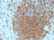 IHC staining of FFPE human spleen with CD45RA antibody (clone K4B5). HIER: steam section in pH 9 10mM Tris with 1mM EDTA for 20 min and allow to cool prior to staining.