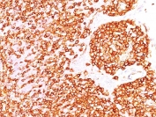 IHC staining of FFPE human tonsil with recombinant CD45R antibody (clone rPTPRC/1460). HIER: steam section in pH 9 10mM Tris with 1mM EDTA for 20 min and allow to cool prior to staining.