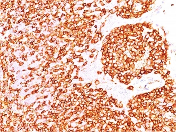 IHC staining of FFPE human tonsil with recombinant CD45R antibody (clone rPTPRC/1460). HIER: steam section in pH 9 10mM Tris with 1mM EDTA for 20 min and allow to cool prior to staining.