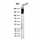Western blot testing of human spleen lysate with recombinant CD45R antibody (clone rPTPRC/1460). Expected molecular weight: 147-220 kDa depending on glycosylation level.