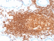 IHC staining of FFPE human lymph node with recombinant CD45RB antibody (clone rPTPRC/1132). HIER: steam section in pH 9 10mM Tris with 1mM EDTA for 20 min and allow to cool prior to staining.