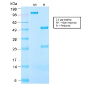 SDS-PAGE analysis of purified, BSA-free recombinant Insulin-like Growth Factor 1 antibody (clone IGF1/2872R) as confirmation of integrity and purity.