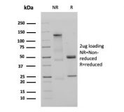 SDS-PAGE analysis of purified, BSA-free recombinant IgM antibody (clone IGHM/3135R) as confirmation of integrity and purity.