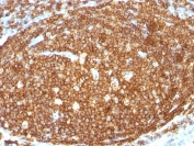 IHC staining of FFPE human tonsil with CD45RB antibody. HIER: steam section in pH 9 10mM Tris with 1mM EDTA for 20 min and allow to cool prior to staining.