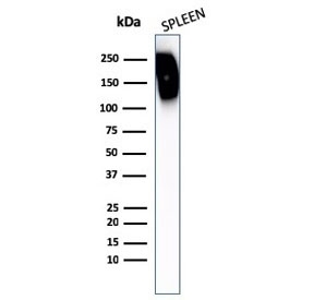 Western blot testing of human spleen lysate with CD45RB antibody. Expected molecular weight: 147-220 kDa depending on glycosylation level.~