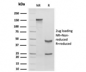 SDS-PAGE analysis of purified, BSA-free recombinant RBP-1 antibody (clone rRBP1/872) as confirmation of integrity and purity.
