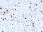 IHC staining of FFPE human spleen with recombinant IgM antibody (clone IGHM/3776R). HIER: boil tissue sections in pH 9 10mM Tris with 1mM EDTA for 10-20 min and allow to cool before testing.