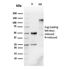 SDS-PAGE analysis of purified, BSA-free recombinant IgM antibody (clone IGHM/3776R) as confirmation of integrity and purity.