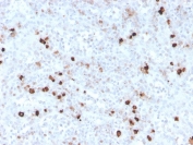 IHC staining of FFPE human spleen with recombinant IgM antibody (clone IGHM/3776R). HIER: boil tissue sections in pH 9 10mM Tris with 1mM EDTA for 10-20 min and allow to cool before testing.