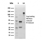 SDS-PAGE analysis of purified, BSA-free recombinant IgM antibody (clone IGHM/3803R) as confirmation of integrity and purity.