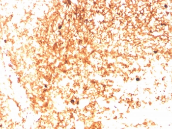 IHC staining of FFPE human tonsil with recombinant IgM antibody (clone IGHM/3803R). HIER: boil tissue sections in pH 9 10mM Tris with 1mM EDTA for 10-20 min and allow to cool before testing.~