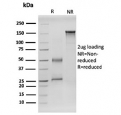 SDS-PAGE analysis of purified, BSA-free RET antibody (clone RET/2599) as confirmation of integrity and purity.
