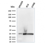 Western blot testing of human spleen, PC3 and liver lysate with C1QA antibody (clone C1QA/2783). Predicted molecular weight ~26 kDa.