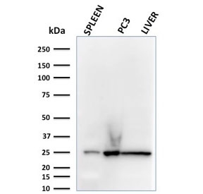 Western blot testing of human spleen, PC3 and liver lysate with C1QA antibody. Predicted molecular weight ~26 kDa.
