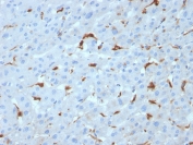 IHC staining of FFPE human liver with C1QA antibody (clone C1QA/2953). HIER: boil tissue sections in pH 9 10mM Tris with 1mM EDTA for 10-20 min and allow to cool before testing.