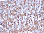 IHC staining of FFPE human liver with C1QA antibody (clone C1QA/2953). HIER: boil tissue sections in pH 9 10mM Tris with 1mM EDTA for 10-20 min and allow to cool before testing.