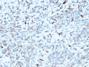 IHC staining of FFPE human kidney with Complement C1q A-Chain antibody (clone C1QA/2952). HIER: boil tissue sections in pH 9 10mM Tris with 1mM EDTA for 10-20 min and allow to cool before testing.