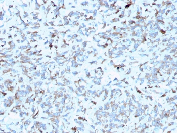 IHC staining of FFPE human kidney with Complement C1q A-Chain antibody (clone C1QA/2952). HIER: boil tissue sections in pH 9 10mM Tris with 1mM EDTA for 10-20 min and allow to cool before testing.